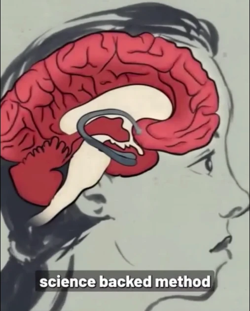 Neurological tinnitus presentation preview